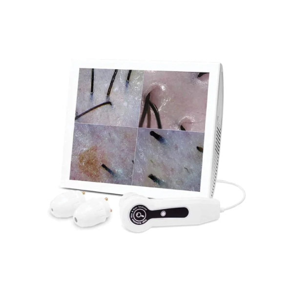 Lizze-15-inch-scalp-and-hair-analyzer دستگاه آنالیز پوست سر و مو 15 اینچ Lizze - تصویر 1